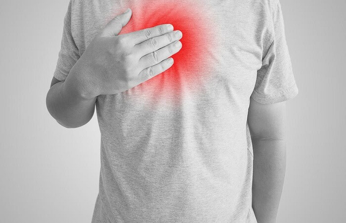 Acid Reflux: Symptoms, Causes and Treatment